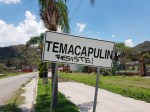 Temacapulin sign 2